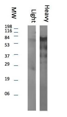 WB analysis of llama IgG light chain (Left) and heavy chain (Right) using GTX20276 Rabbit Anti-llama IgG (Heavy Chain) antibody. Dilution : 1:250 WB analysis of llama IgG light chain (Left) and heavy chain (Right) using GTX20276 Rabbit Anti-llama IgG (Heavy Chain) antibody. Dilution : 1:250