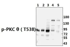 WB analysis of various samples using GTX20304 PKC theta (phospho Thr538) antibody. Lane1 : The Spleen tissue lysate of Rat Lane2 : The Spleen tissue lysate of Mouse Lane3 : L02 treated with LPS(100ng/ml) for 30 minutes whole cell lysate Lane4 : HEK293T treated with Etoposide(20ng/ml) for 6 hours whole cell lysate Lane5 : HEK293T treated with TNFalpha(20ng/ml)for 20 minutes whole cell lysate Dilution : 1:500 Loading : 40ug WB analysis of various samples using GTX20304 PKC theta (phospho Thr538) antibody. Lane1 : The Spleen tissue lysate of Rat Lane2 : The Spleen tissue lysate of Mouse Lane3 : L02 treated with LPS(100ng/ml) for 30 minutes whole cell lysate Lane4 : HEK293T treated with Etoposide(20ng/ml) for 6 hours whole cell lysate Lane5 : HEK293T treated with TNFalpha(20ng/ml)for 20 minutes whole cell lysate Dilution : 1:500 Loading : 40ug