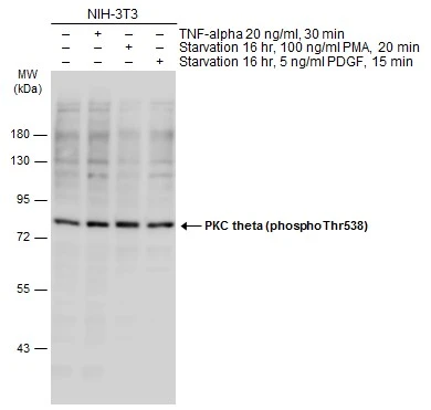 Untreated (-) and treated (+) NIH-3T3 whole cell extracts (60 microg) were separated by 7.5% SDS-PAGE, and the membrane was blotted with PKC theta (phospho Thr538) antibody (GTX20304) diluted at 1:1000. The HRP-conjugated anti-rabbit IgG antibody (GTX213110-01) was used to detect the primary antibody.