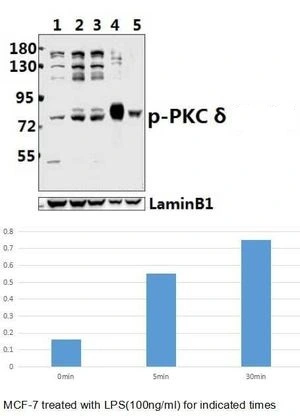 WB analysis of various samples using GTX20305 PKC delta (phospho Thr507) antibody. Lane1 : MCF-7 whole cell lysate Lane2 : MCF-7 treated with LPS(100ng/ml) for 5 minutes whole cell lysate Lane3 : MCF-7 treated with LPS(100ng/ml) for 30 minutes whole cell lysate Dilution : 1:500 WB analysis of various samples using GTX20305 PKC delta (phospho Thr507) antibody. Lane1 : MCF-7 whole cell lysate Lane2 : MCF-7 treated with LPS(100ng/ml) for 5 minutes whole cell lysate Lane3 : MCF-7 treated with LPS(100ng/ml) for 30 minutes whole cell lysate Dilution : 1:500