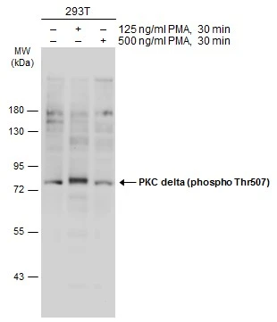 Untreated (-) and treated (+) 293T whole cell extracts (60 microg) were separated by 7.5% SDS-PAGE, and the membrane was blotted with PKC delta (phospho Thr507) antibody (GTX20305) diluted at 1:1000. The HRP-conjugated anti-rabbit IgG antibody (GTX213110-01) was used to detect the primary antibody.