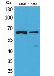 IHC-P analysis of human breast tissue using GTX20307 NFkB p65 (acetyl Lys218) antibody. Dilution : 1:100