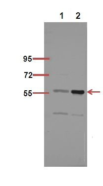 WB analysis of human breast tissu lysate using GTX20307 NFkB p65 (acetyl Lys218) antibody. Dilution : 1:100