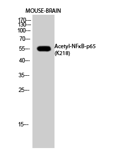 WB analysis of mouse brain cell lysate using GTX20307 NFkB p65 (acetyl Lys218) antibody.