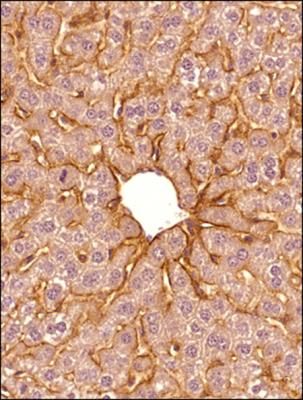 ICC/IF analysis of human fibroblasts using GTX20396 SR-BI antibody. Green : primary antibody Blue : DAPI Dilution : 1:100 Fixation : 4% PFA Permeabilization : 0.2% Tween