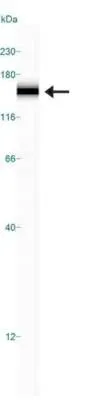 WB analysis of HeLa cell lysate using GTX20499 Rad50 antibody. WB analysis of HeLa cell lysate using GTX20499 Rad50 antibody.
