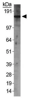 WB analysis of HeLa nuclear extract using GTX20499 Rad50 antibody.