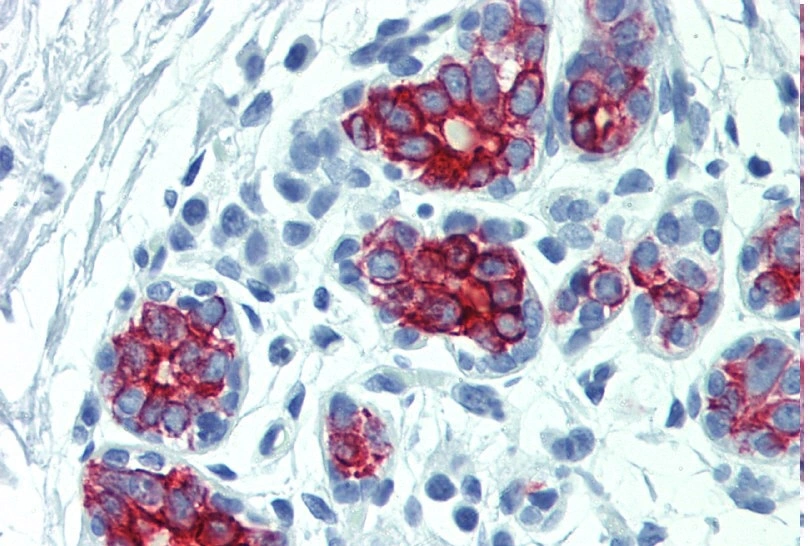 IHC-P analysis of human breast tissue using GTX20670 Cytokeratin 7 + 17 antibody [C-46].
