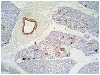 Immunohistochemistry staining of pancreas (paraffin-embedded sections) with anti-Cytokeratin 7+17 (GTX20670)