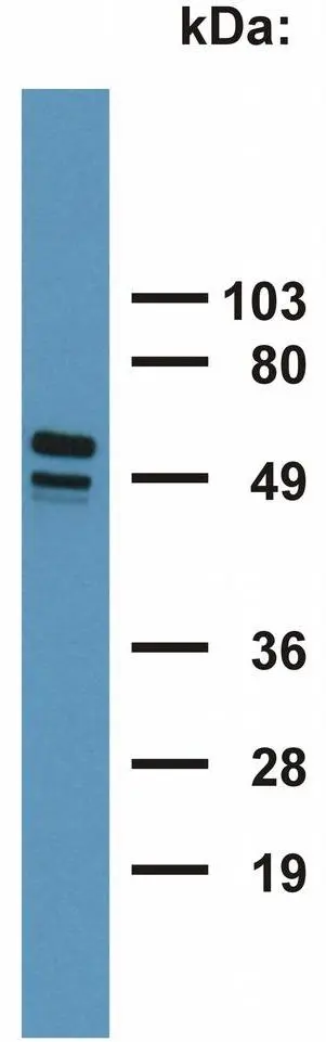 WB analysis of HeLa cell lysate using GTX20670 Cytokeratin 7 + 17 antibody [C-46].