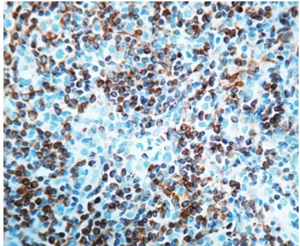 Formalin fixed paraffin embedded human tonsil stained with GTX20694. Formalin fixed paraffin embedded human tonsil stained with GTX20694.