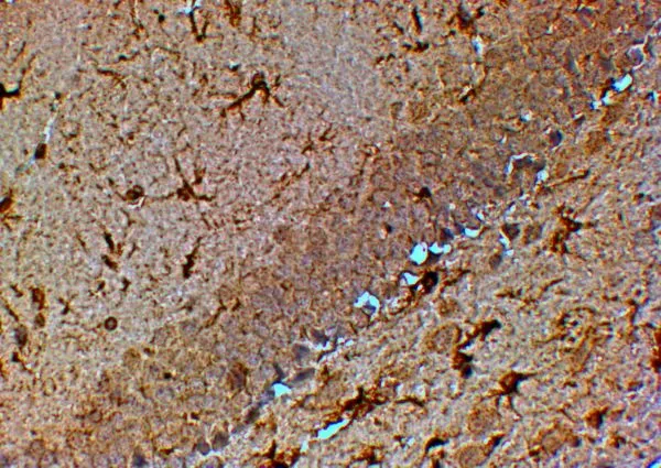IHC-P analysis of mouse hippocampus using GTX20729 TRPM7 antibody. Antigen retrieval : citrate buffer pH 6 Dilution : 4ug/ml