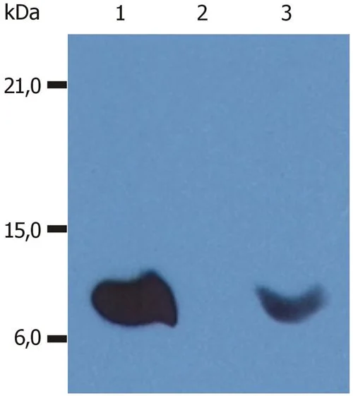 WB analysis of various samples (non-reducing) using GTX20759 beta 2 Microglobulin antibody [B2M-01].<br>Lane 1 : Raji cell lysate<br>Lane 2 : EL4 cell lysate<br>Lane 3 : U937 cell lysate