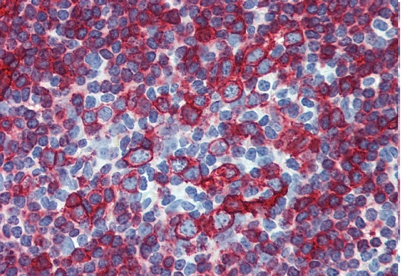 IHC-P analysis of human small intestine tissue using GTX20766 HLA-DR + HLA-DP antibody [HL-38].