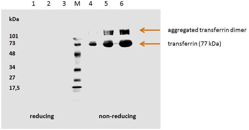 WB analysis of human transferrin  using GTX20769 Transferrin antibody [HTF-14].<br>Lane 1-3 : reducing hTransferrin (5?g/well, 3?g/well, 1?g/well)<br>Lane 4-6 : non-reducing hTransferrin(1?g/well, 3?g/well, 5?g/well)