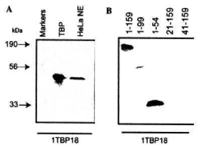 A.Reactivity with recombinant human TATA Binding Protein and HeLa cell nuclear extract with GTX20818 at 2ug/ml.B.It's a Western blot with GTX20818 at 2ug/ml on fragments of TATA Binding Protein in order to identify the epitopes recognized by this antibody