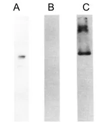 WB analysis of (A) normal human plasma, (B) HMWK-deficient plasma, and (C) purified HMWK proteins using GTX21004 HMW Kininogen antibody [C11C1].