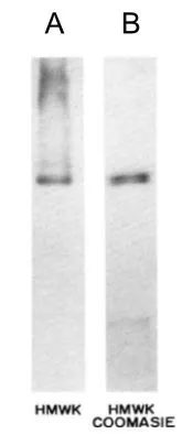 WB analysis of purified HMWK protein using GTX21005 HMW Kininogen antibody [2B5].<br>Lane A : WB staining<br>Lane B : Coomassie Blue staining