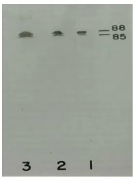 WB analysis of purified human prekallikrein protein (Lane 1) and normal human plasma (Lanes 2 and 3) lysates using GTX21006 Plasma Kallikrein 1B antibody [13G11].