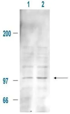 Affinity Purified Anti-MDM2 pS185 (Rabbit) is shown to detect a 102 kDa band (arrow) corresponding to phosphorylated mouse MDM2 present in a 293T whole cell lysate. Cells were serum-starved for 24 hours prior to harvest. Approxi-mately 20 ug of lysate was loaded per lane for SDS-PAGE. Untreated cells are shown in lane 1, whereas cells in lane 2 were treated with IGF-1 (100 ng/ml) for 20 min prior to harvest. Follow reaction of antibody with a 1:2000 dilution of HRP Goat-a-Rabbit IgG for visualization. Affinity Purified Anti-MDM2 pS185 (Rabbit) is shown to detect a 102 kDa band (arrow) corresponding to phosphorylated mouse MDM2 present in a 293T whole cell lysate. Cells were serum-starved for 24 hours prior to harvest. Approxi-mately 20 ug of lysate was loaded per lane for SDS-PAGE. Untreated cells are shown in lane 1, whereas cells in lane 2 were treated with IGF-1 (100 ng/ml) for 20 min prior to harvest. Follow reaction of antibody with a 1:2000 dilution of HRP Goat-a-Rabbit IgG for visualization.