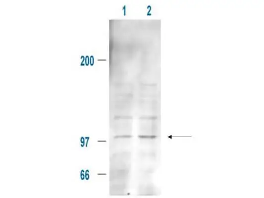 WB analysis of 293T whole cell lysate using GTX21094 MDM2 (phospho Ser185) antibody. Lane 1 : Untreated whole cell lysate Lane 2 : 100 ng/mL IGF-1 treated whole cell lysate Dilution : 20 microg