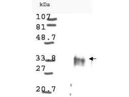 Western blot analysis is shown using GeneTex Anti-Cyclin D1 antibody (GTX21224) to detect Human Cyclin D1 present in asynchronous HN30 cell lysates. HN30 cells, are from head and neck cancer cells that over express cyclin B1 and D1. Comparison to a molecular weight marker indicates a band of ~34 kDa corresponding to the expected molecular weight for the protein (arrowhead). The blot was incubated with a 1:500 dilution of the antibody at room temperature. Detection occurred using a 1:10,000 of HRP conjugated Goat-a-Rabbit IgG GTX27090 and chemiluminescence reagent with a 1min exposure time. Other detection systems will yield similar results. Western blot analysis is shown using GeneTex Anti-Cyclin D1 antibody (GTX21224) to detect Human Cyclin D1 present in asynchronous HN30 cell lysates. HN30 cells, are from head and neck cancer cells that over express cyclin B1 and D1. Comparison to a molecular weight marker indicates a band of ~34 kDa corresponding to the expected molecular weight for the protein (arrowhead). The blot was incubated with a 1:500 dilution of the antibody at room temperature. Detection occurred using a 1:10,000 of HRP conjugated Goat-a-Rabbit IgG GTX27090 and chemiluminescence reagent with a 1min exposure time. Other detection systems will yield similar results.