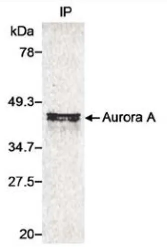 IP analysis of 35S-Met-labeled whole cell lysate transfected with a human Aurora A expression construct using GTX21287 Aurora A antibody. IP reaction : 2-10microg/mg lysate IP analysis of 35S-Met-labeled whole cell lysate transfected with a human Aurora A expression construct using GTX21287 Aurora A antibody. IP reaction : 2-10microg/mg lysate