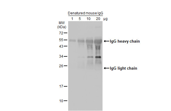 E2F1 antibody [16G7] detects E2F1 protein at nucleus in mouse cervix by immunohistochemical analysis. Sample: Paraffin-embedded mouse cervix.