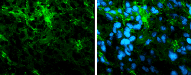 Immunofluorescence photomicrographs of frozen sections of mouse brain.