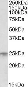 WB analysis of human bone marrow lysate using GTX21330 Musculin antibody. Dilution : 1ug/ml Loading : 35ug protein in RIPA buffer