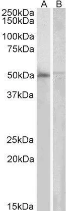 WB analysis of human bone marrow (A) and PBL (B) lysates using GTX21357 DOK3 antibody, C-term. Dilution : 2microg/ml Loading : 35microg protein in RIPA buffer WB analysis of human bone marrow (A) and PBL (B) lysates using GTX21357 DOK3 antibody, C-term. Dilution : 2microg/ml Loading : 35microg protein in RIPA buffer