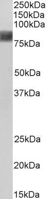WB analysis of HEK293 cell lysate using GTX21374 Cortactin antibody, N-term. Dilution : 0.03microg/ml Loading : 35microg protein in RIPA buffer