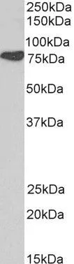 WB analysis of human brain (cerebellum) lysate using GTX21374 Cortactin antibody, N-term. Dilution : 0.1microg/ml Loading : 35microg protein in RIPA buffer