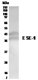 Western blot analysis of ESE-1 in T84 colon carcinoma cells with anti-E SE-1 at a 1:500 dilution. Recognizes both isoforms of ESE-1