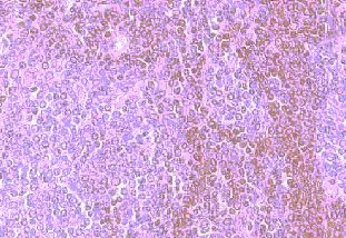 IHC-P analysis of human spleen tissue using GTX21666 CCR8 antibody. IHC-P analysis of human spleen tissue using GTX21666 CCR8 antibody.