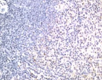 IHC analysis of human spleen tissue using GTX21675 DR5 antibody. IHC analysis of human spleen tissue using GTX21675 DR5 antibody.