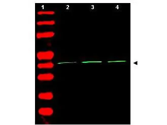 WB analysis of various samples using GTX21801 beta Actin antibody. Lane 1 : Protein ladder Lane 2 : 293T whole cell lysate Lane 3 : A549 whole cell lysate Lane 4 : Mouse brain tissue lysate Loading : 35 microg Dilution : 1:500 WB analysis of various samples using GTX21801 beta Actin antibody. Lane 1 : Protein ladder Lane 2 : 293T whole cell lysate Lane 3 : A549 whole cell lysate Lane 4 : Mouse brain tissue lysate Loading : 35 microg Dilution : 1:500