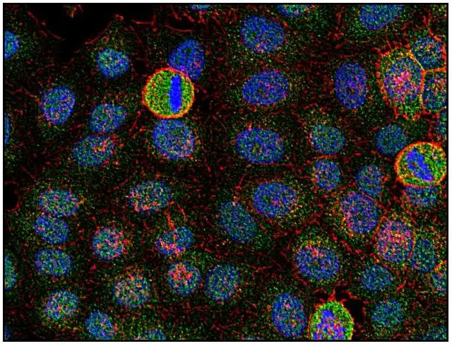 ICC/IF analysis of HeLa cells using GTX21881 FYN antibody [FYN-01]. Green : Primary antibody Red : Actin Blue : DAPI