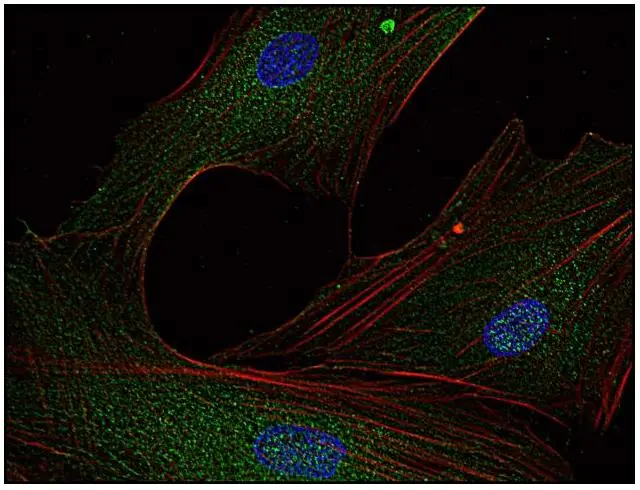 ICC/IF analysis of human primary fibroblasts using GTX21881 FYN antibody [FYN-01]. Green : Primary antibody Red : Actin Blue : DAPI Diultion : 5microg/ml