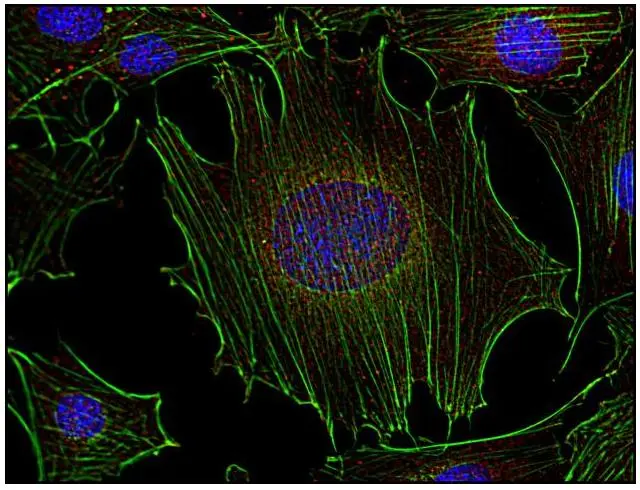 ICC/IF analysis of mouse transformed fibroblasts using GTX21881 FYN antibody [FYN-01]. Green : Primary antibody Red : Actin Blue : DAPI