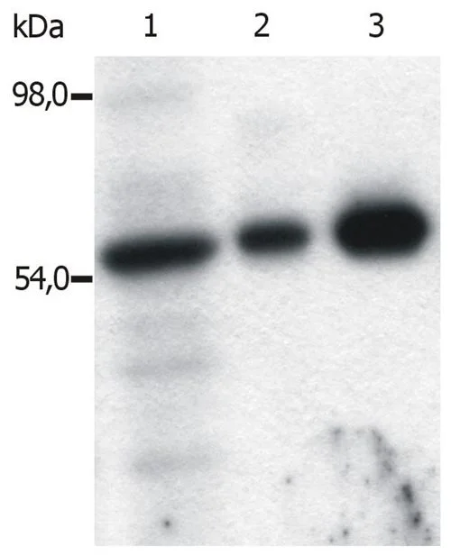 IP analysis of T cells isolated from fresh buffy coats using GTX21881 FYN antibody [FYN-01]. Lanes differ in amount of T cell lysate loaded on the immunosorbent. Lane 1 : Original lysate of T cells Lane 2-3 : Immunoprecipitated material eluted from affinity sorbent (FYN-01 coupled to Sepharose beads)