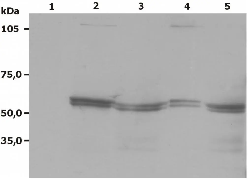 WB analysis of various samples (non-reducing) using GTX21890 LYN antibody [LYN-01]. Lane 1 : negative control Lane 2 : RBL cell lysate Lane 3 : Jurkat cell lysate Lane 4 : A-431 cell lysate Lane 5: U-937 cell lysate