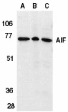 Western blot analysis of AIF in K562 cell lysate (A), rat heart (B), and mouse heart (C) tissue lysates with AIF (GTX21998) (IN) antibody at 1microg/ml.