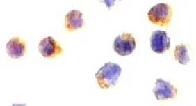 ICC/IF analysis of Jurkat cells using GTX21999 AIF antibody.
