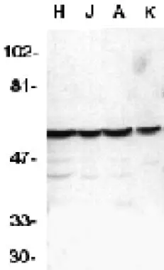 Western blot analysis of Caspase-10 in HeLa (H), Jurkat (J), A431 (A), K562 (K) whole cell lysates with Caspase-10 antibody (GTX22012) at 1microg/ml. Western blot analysis of Caspase-10 in HeLa (H), Jurkat (J), A431 (A), K562 (K) whole cell lysates with Caspase-10 antibody (GTX22012) at 1microg/ml.