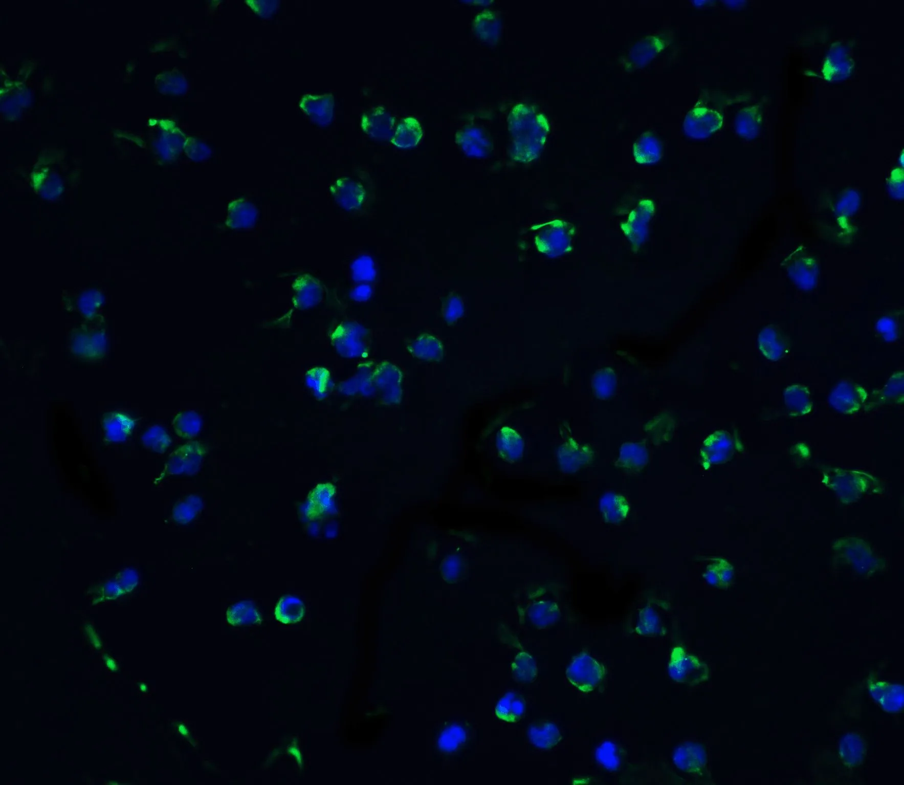 ICC/IF analysis of Jurkat cells using GTX22057 DAP Kinase 3 antibody. Green : Primary antibody Blue : DAPI Dilution : 5 microg/ml ICC/IF analysis of Jurkat cells using GTX22057 DAP Kinase 3 antibody. Green : Primary antibody Blue : DAPI Dilution : 5 microg/ml