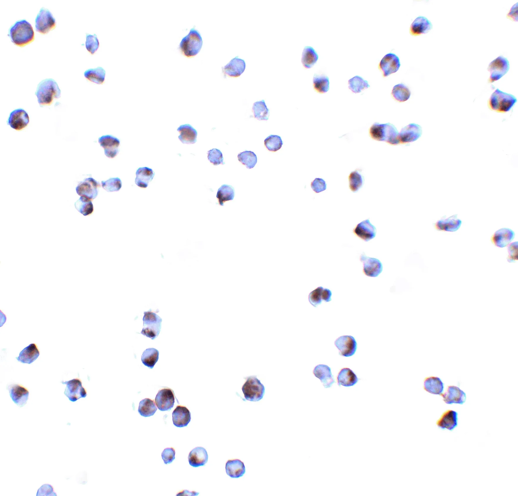 ICC/IF analysis of Jurkat cells using GTX22057 DAP Kinase 3 antibody. Dilution : 10 microg/ml