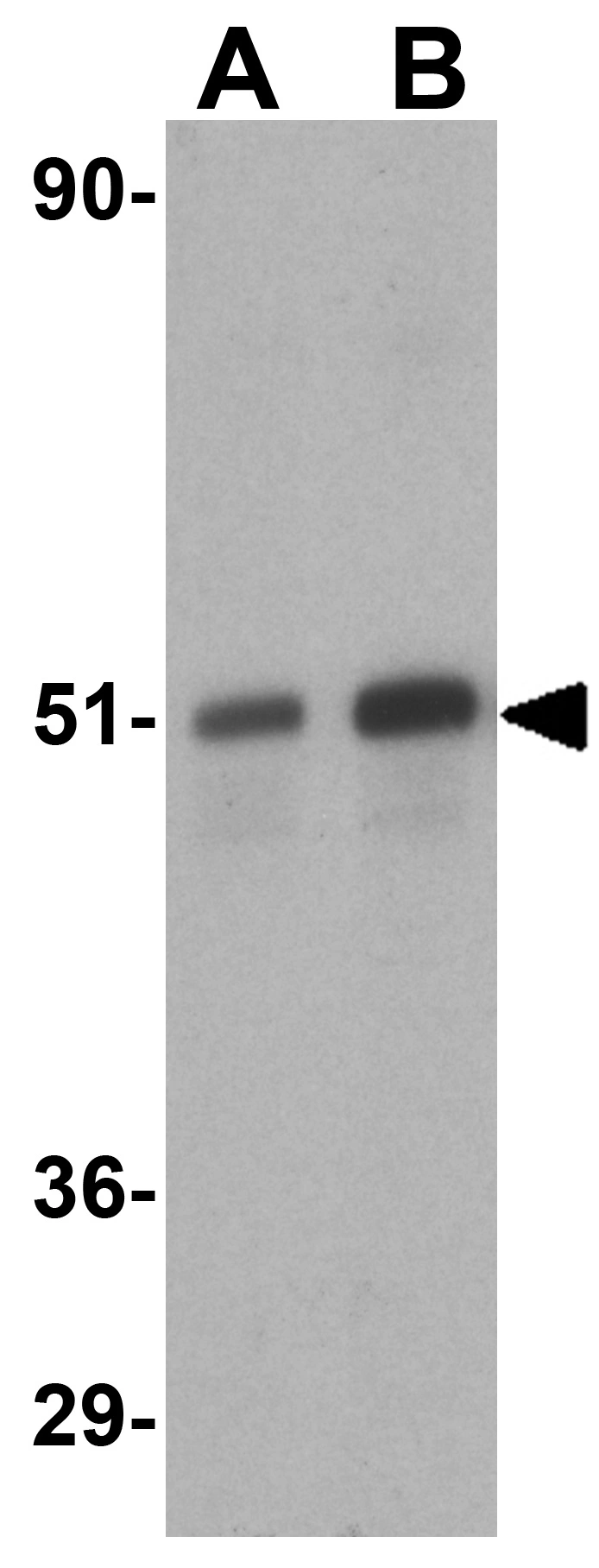 WB analysis of HeLa (Lane A) and Jurkat (Lane B) lysates using GTX22057 DAP Kinase 3 antibody. Dilution : 1microg/ml