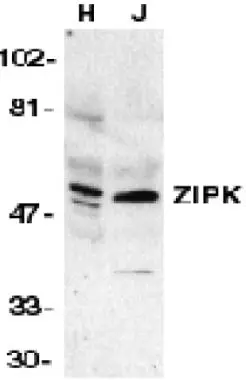 Western blot analysis of ZIP kinase in HeLa (H) and Jurkat (J) cell lysates with ZIP kinase antibody (GTX22057) at 1 g/ml.