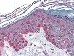 IHC-P analysis of human skin tissue using GTX22098 Cyclin T1 antibody. Dilution : 1:500 IHC-P analysis of human skin tissue using GTX22098 Cyclin T1 antibody. Dilution : 1:500